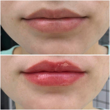 Labios Voluminosos y Seductores: El Secreto Está Aquí